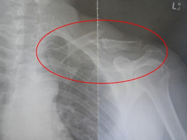 The Perils of Cruising...